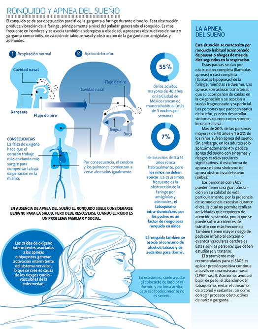 Ronquido y apnea del sueño