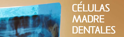 Células madre dentales
